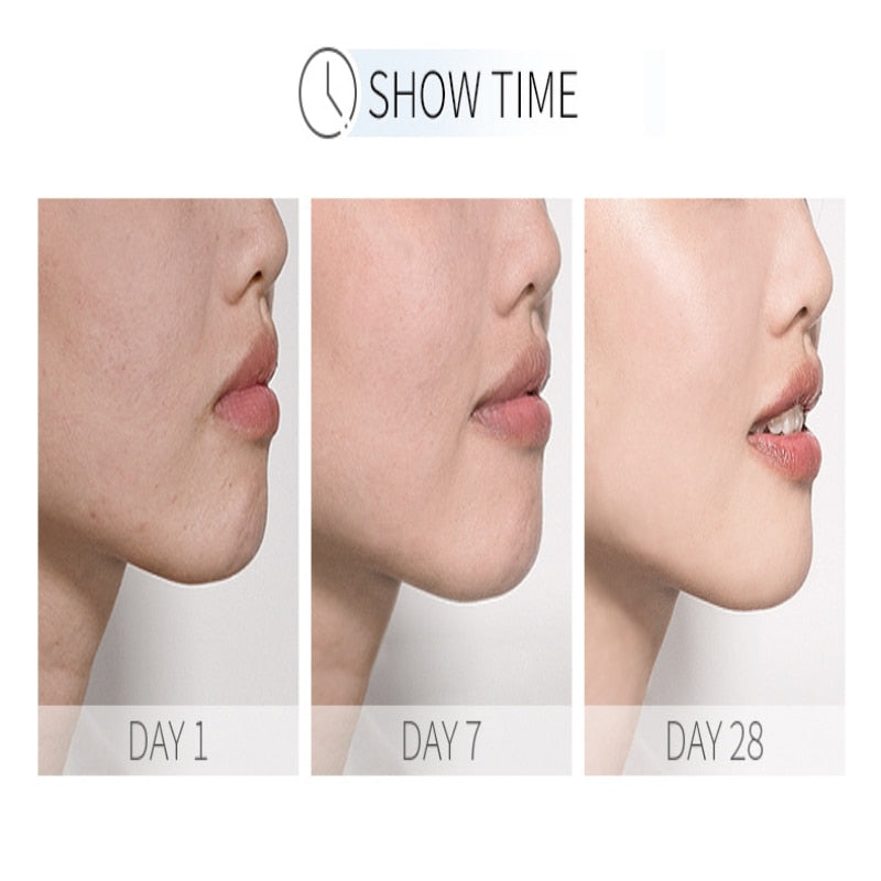 LAIKOU Nicotinamide Serum - Whitening, Moisturizing & Anti-Aging Face Serum