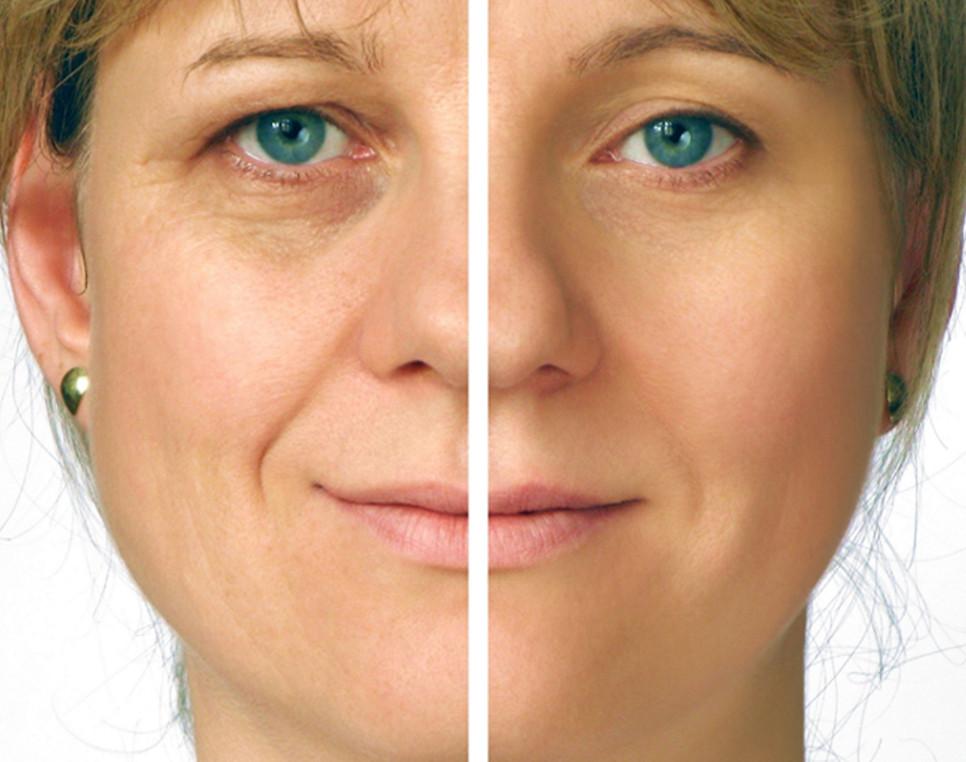 Bio-Anti Aging Treatment Set