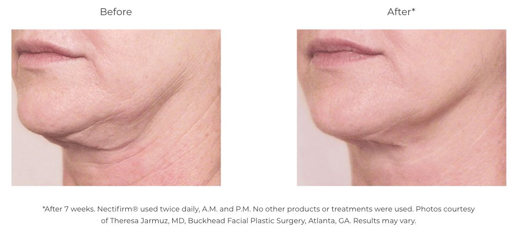 Revision Skincare Nectifirm® (1.7 oz) - Neck & Décolletage Firming Cream